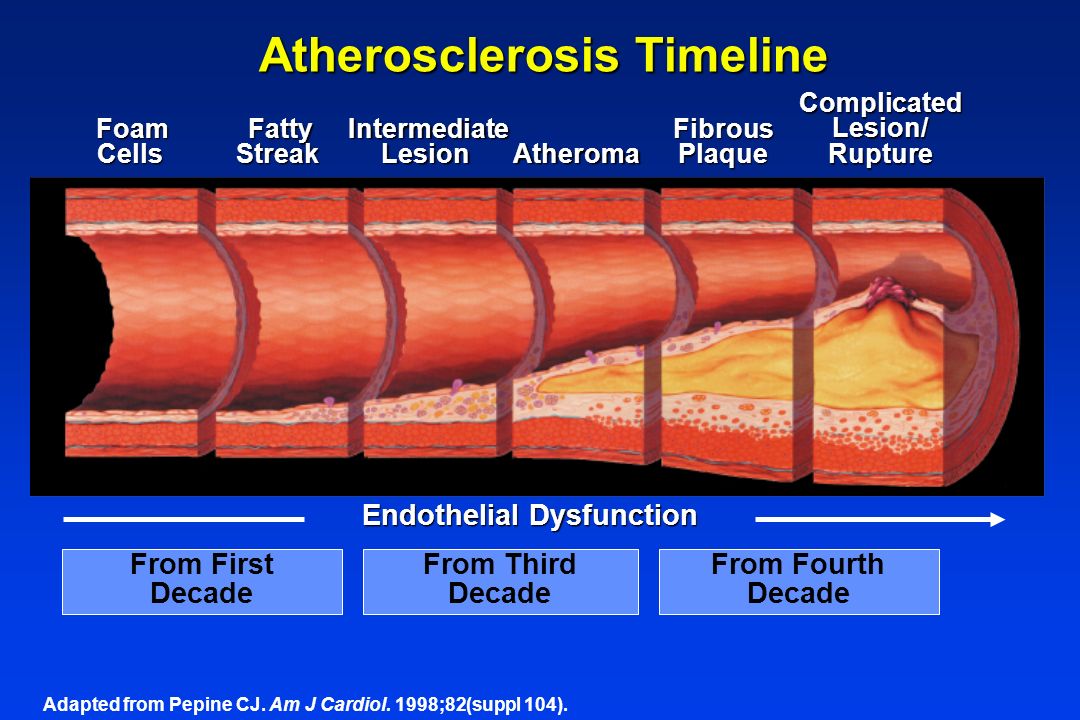 Артерий атеросклероз латынь. Атеросклероз аорты и сосудов. Повреждение сосудистой стенки атеросклероз.