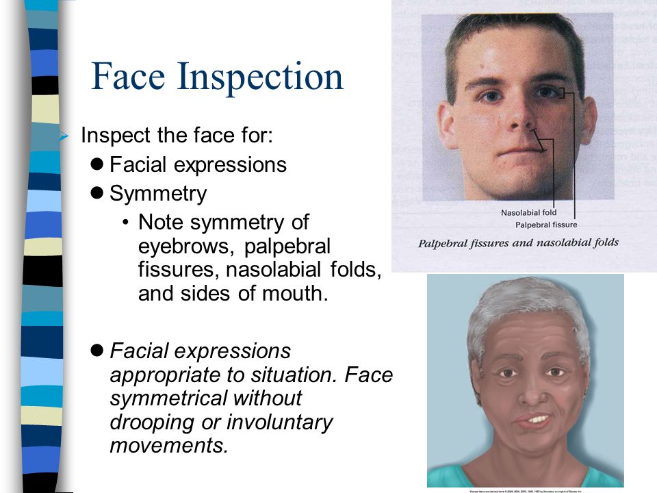 Head, Eyes, Ears, Nose, Mouth, & Neck - ppt video online download