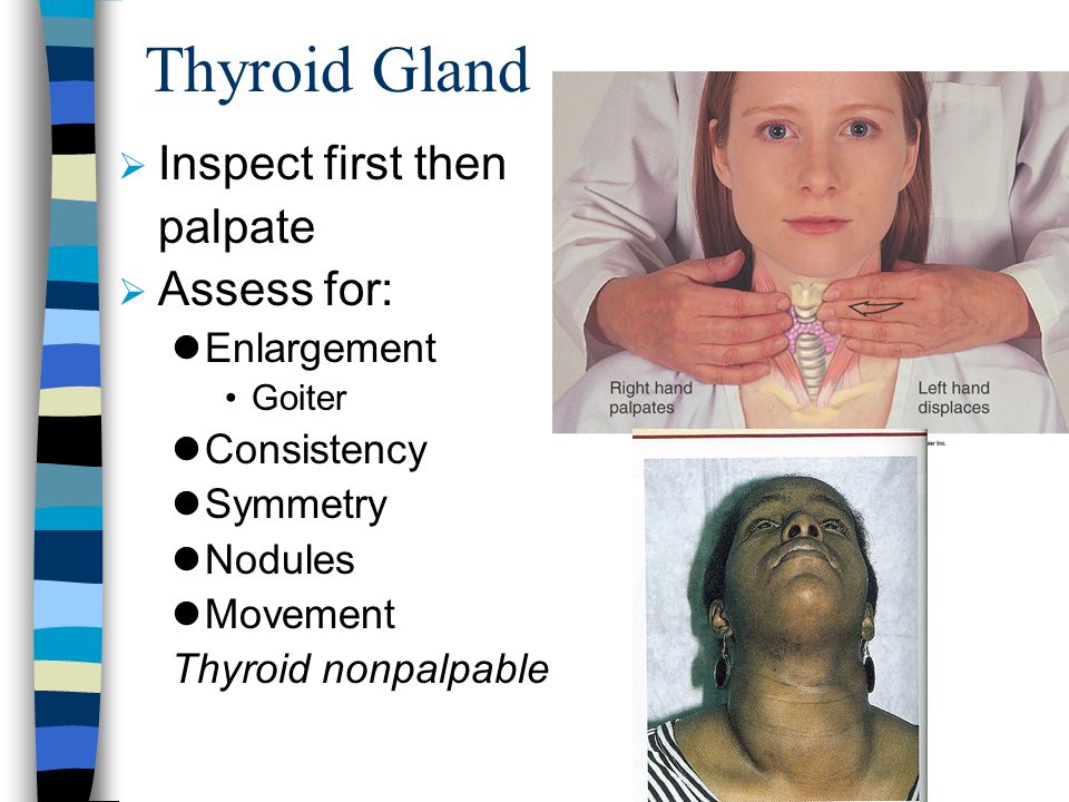 Head Eyes Ears Nose Mouth Neck Ppt Video Online Download