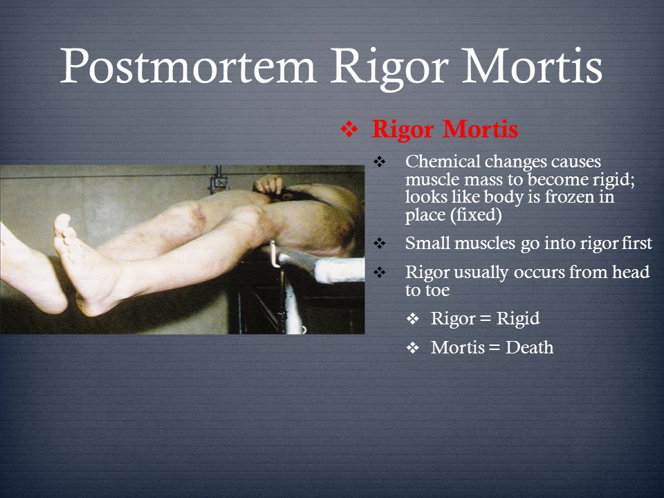 Rigor mortis autopsy