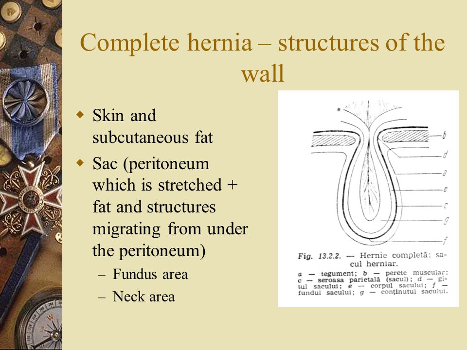 Hernia of the antero-lateral abdominal wall - ppt download