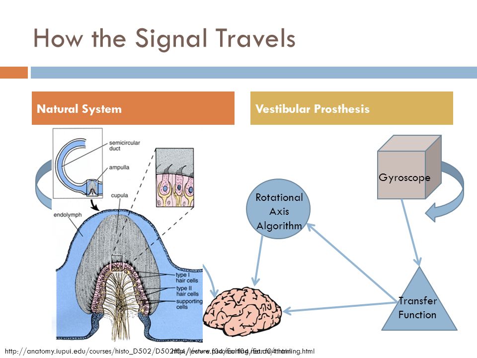 How the Signal Travels Natural System Vestibular Prosthesis Gyroscope