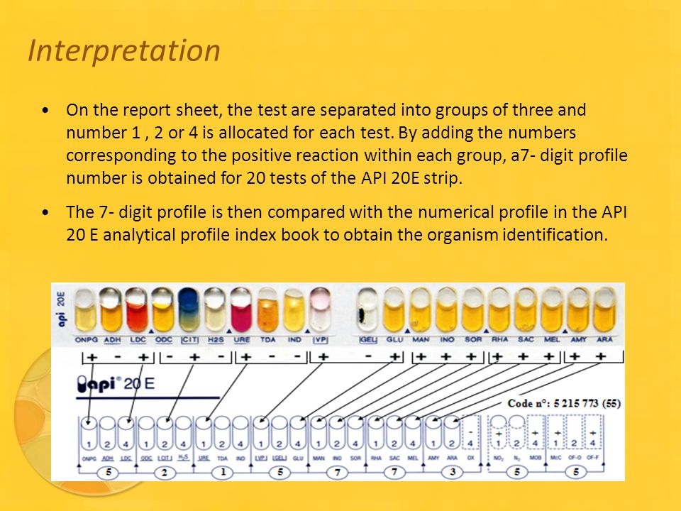 Api 20e Color Chart