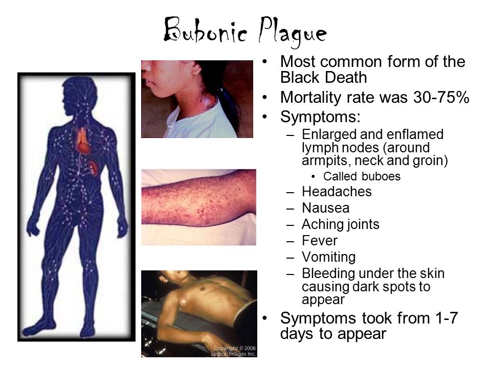 The Black Death Miss K Guppy Ppt Video Online Download