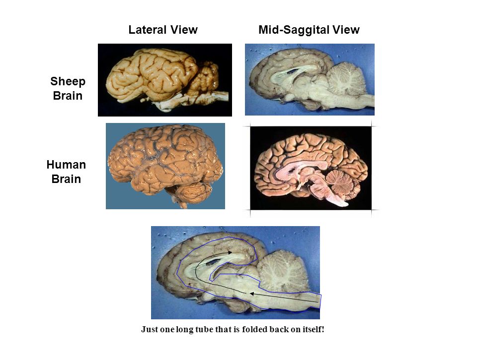 Sheep Brain Dissection Ppt Download