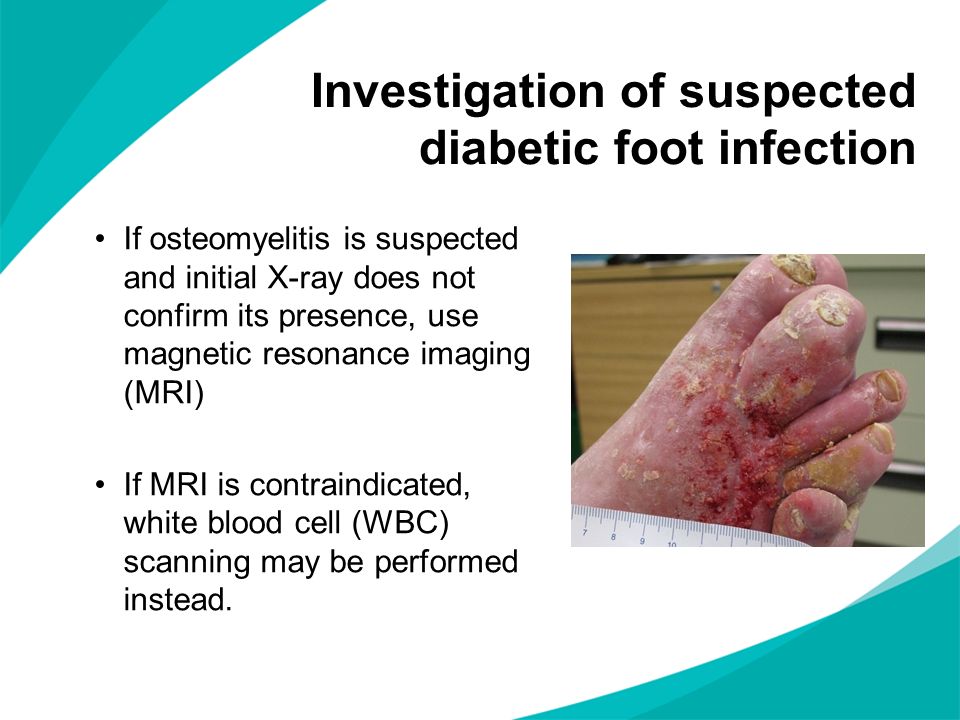 Investigation of suspected diabetic foot infection