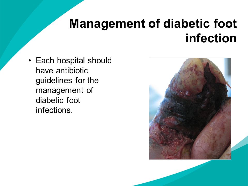 Management of diabetic foot infection