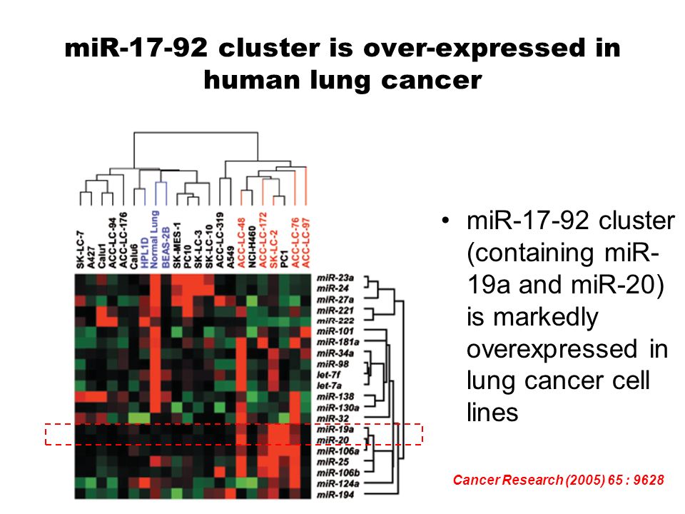 miR cluster is over-expressed in human lung cancer
