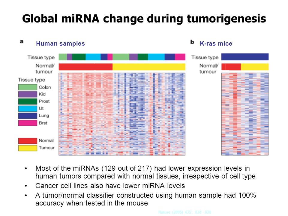 Global miRNA change during tumorigenesis