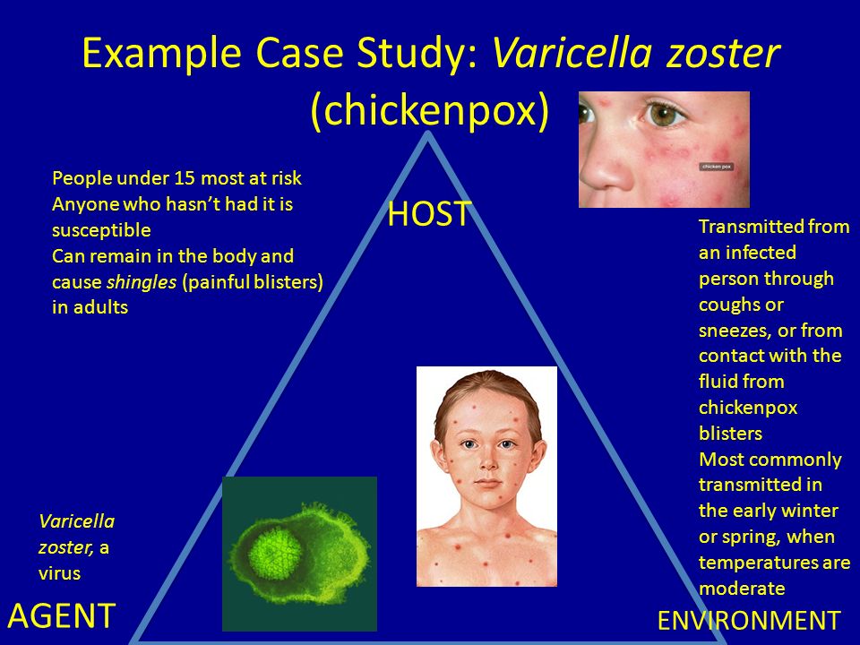 epidemiologic triangle of chickenpox