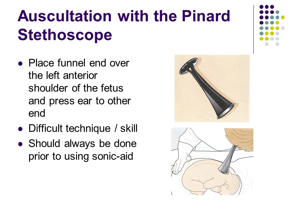 Auscultation with the Pinard Stethoscope