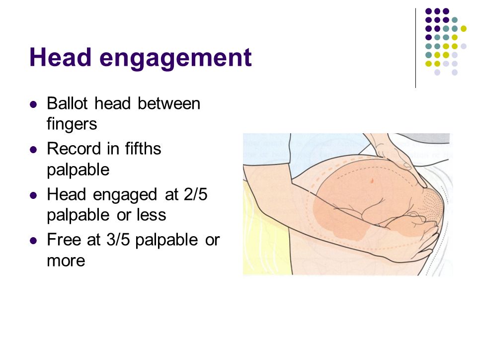 Head engagement Ballot head between fingers Record in fifths palpable