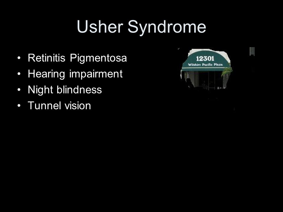 Usher Syndrome Retinitis Pigmentosa Hearing impairment Night blindness
