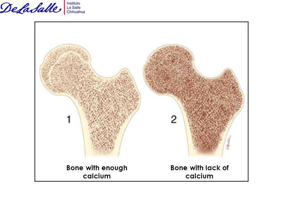 5 костей губчатых. Губчатая и компактная костная ткань. Плотная кость. Разрежения губчатой кости. Губчатая кость.