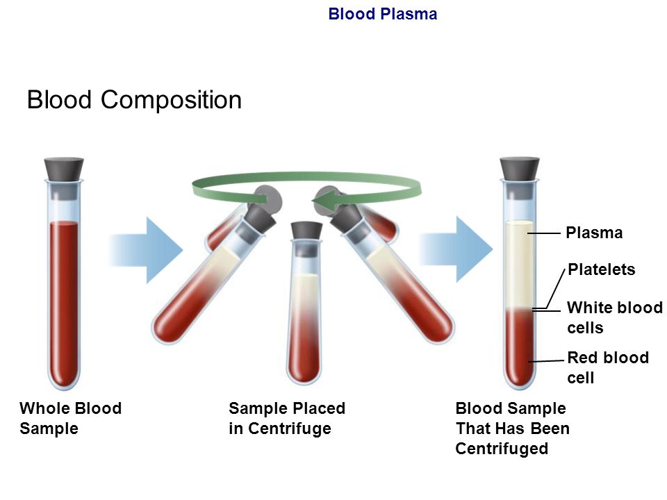 Иммунофиксация сыворотки крови. Плазма и сыворотка крови. Сыворотка крови и плазма крови. Сыворотка крови в пробирке.