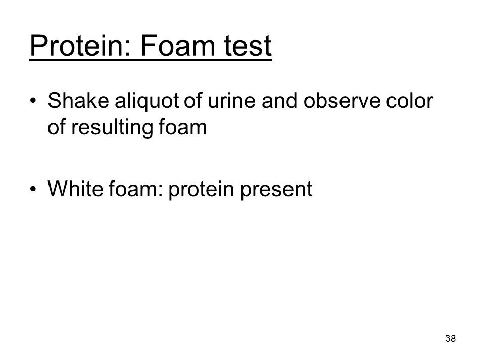 Protein: Foam test Shake aliquot of urine and observe color of resulting foam. White foam: protein present.