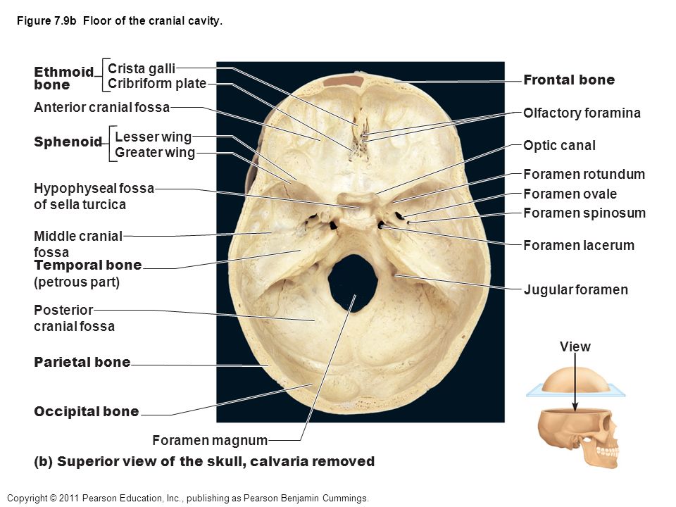 Отдельный отверстие. Скат анатомия черепа латынь. Яремное отверстие черепа. Отверстия черепа анатомия. Основание черепа анатомия человека.