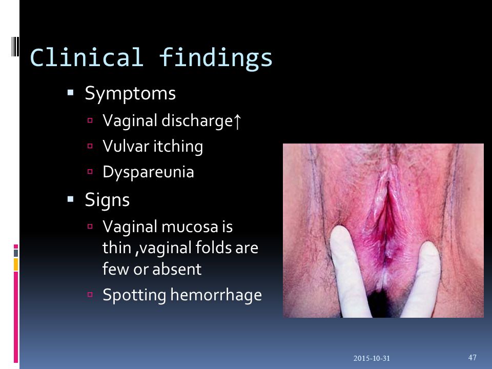 What Is Vaginal Itching