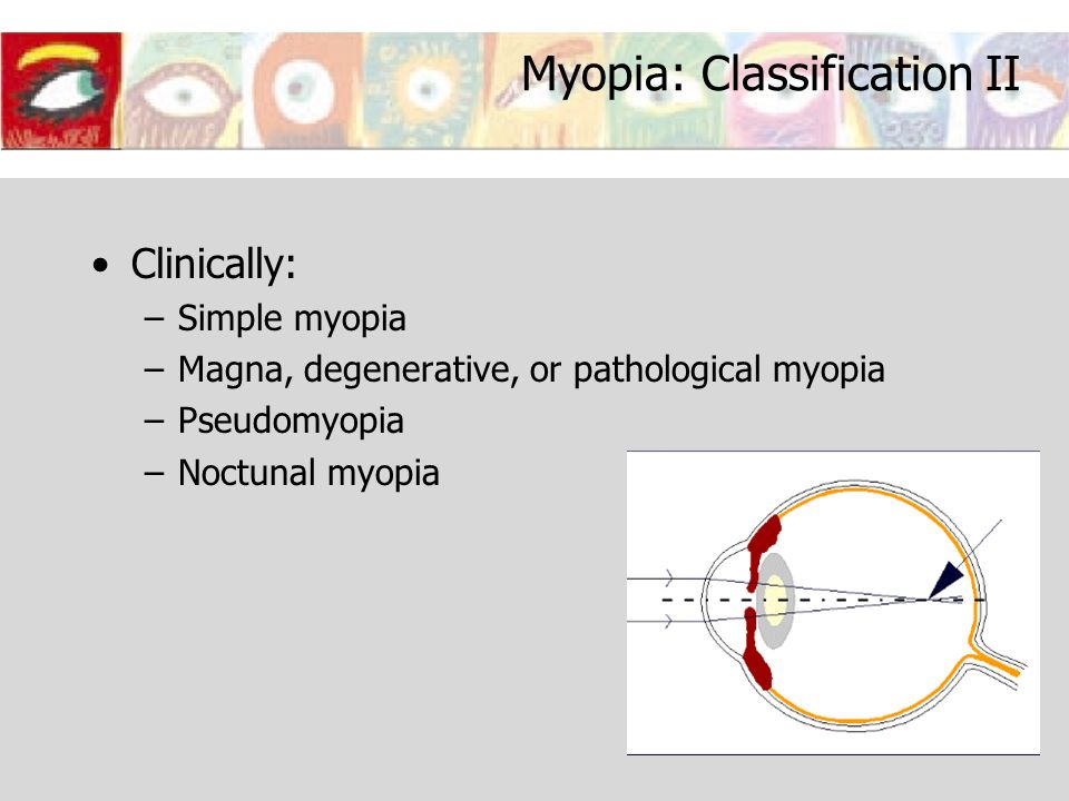 myopia téma