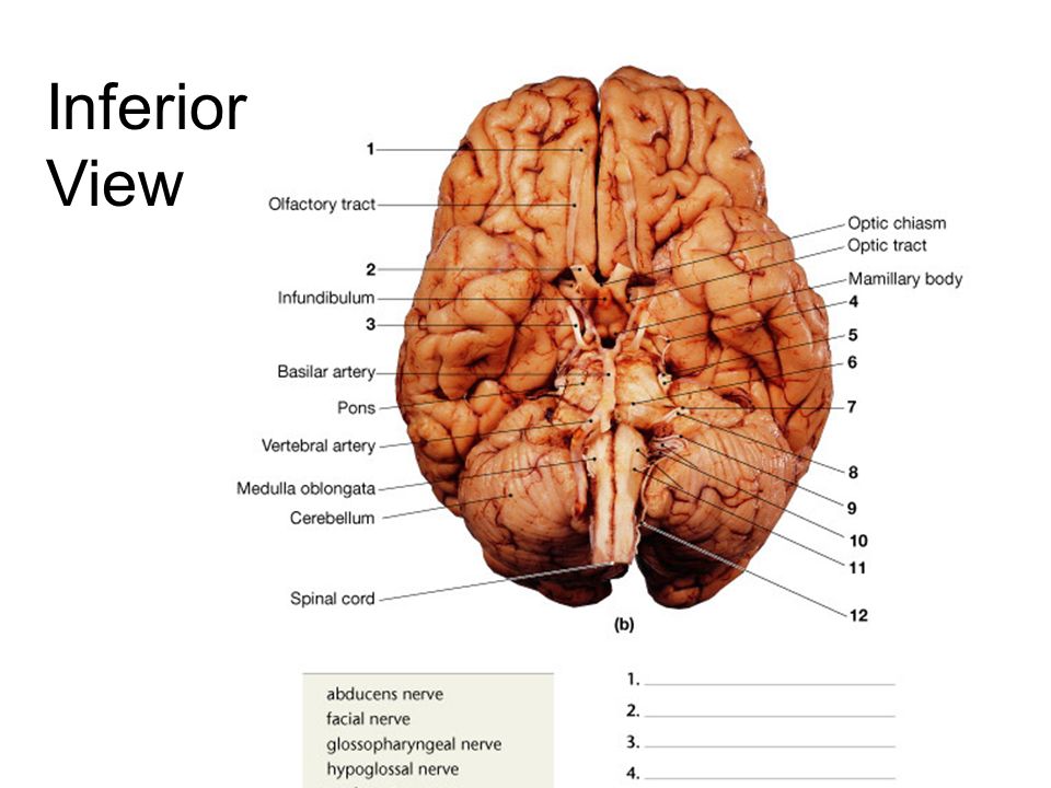 Cranial Nerves Brain Dissection Ppt Video Online Download