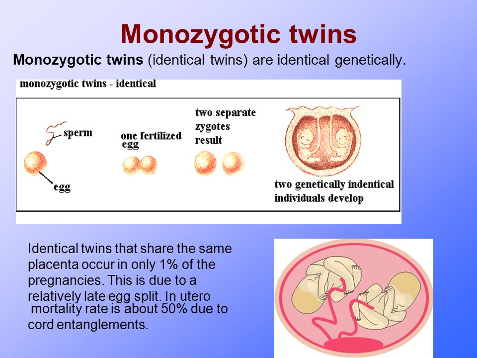 Identical twin pregnancy