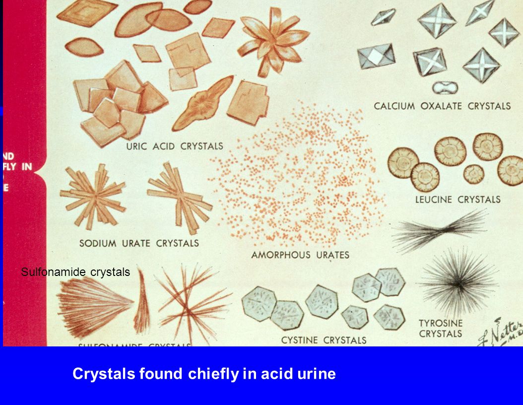 Кристаллы кальция в моче у мужчин. Кристаллы мочевой кислоты под микроскопом. Оксалат кальция в растениях. Кристаллы оксалата кальция. Соли оксалата кальция в моче микроскопия.