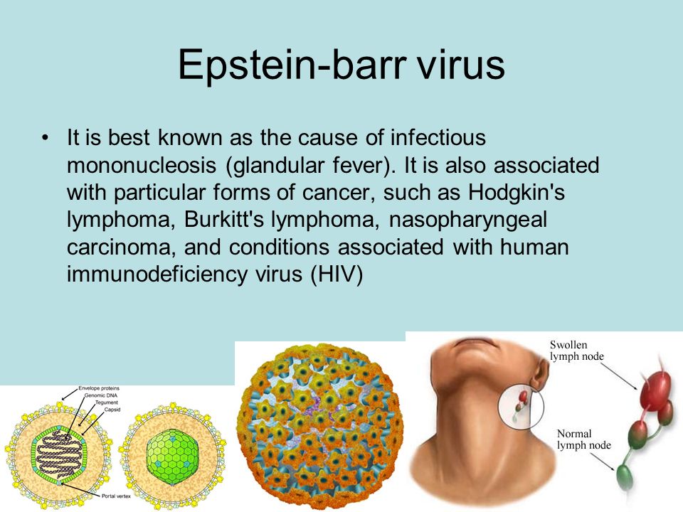 Epstein barr virus ebna. Вирус Эпштейна-Барр структура. Вирус Эпштейна-Барр симптомы.
