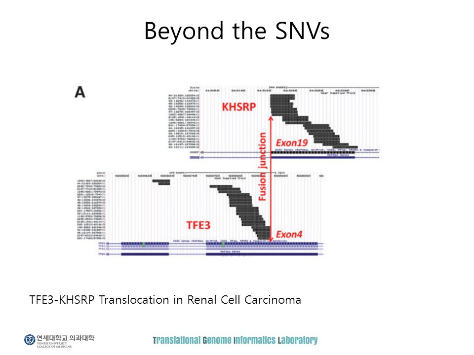 Beyond the SNVs TFE3-KHSRP Translocation in Renal Cell Carcinoma
