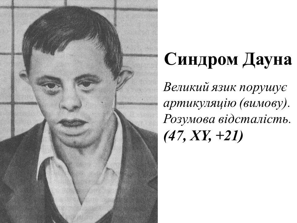 Патау Додик Это
