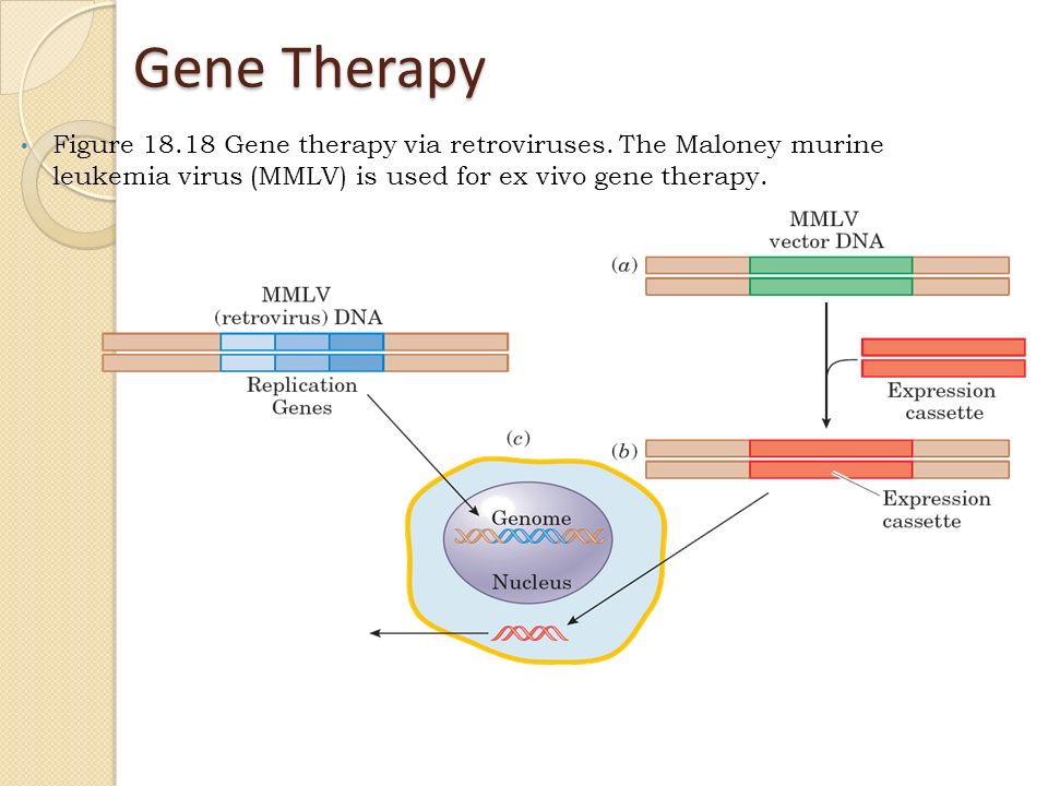 Gene Therapy. 