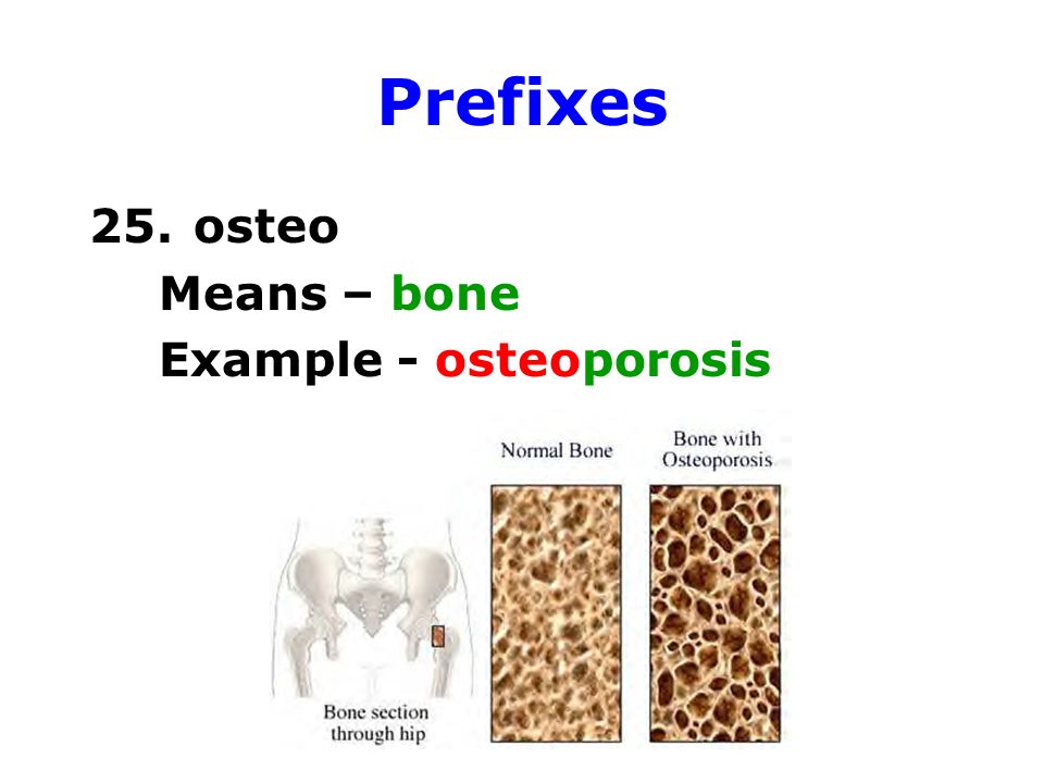 Prefixes 25. osteo Means – bone Example - osteoporosis