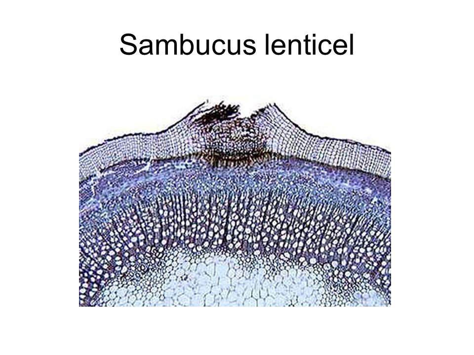 Sambucus lenticel