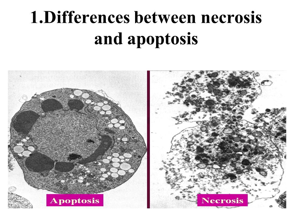 Презентация на тему некроз апоптоз