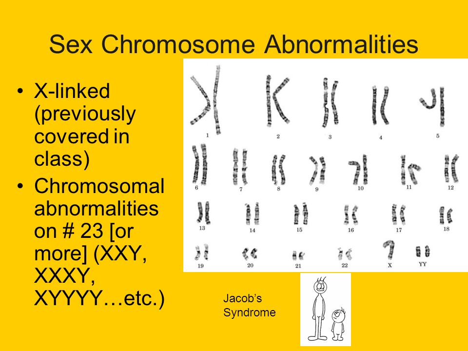 Gene Survival And Death On The Human Y Chromosome