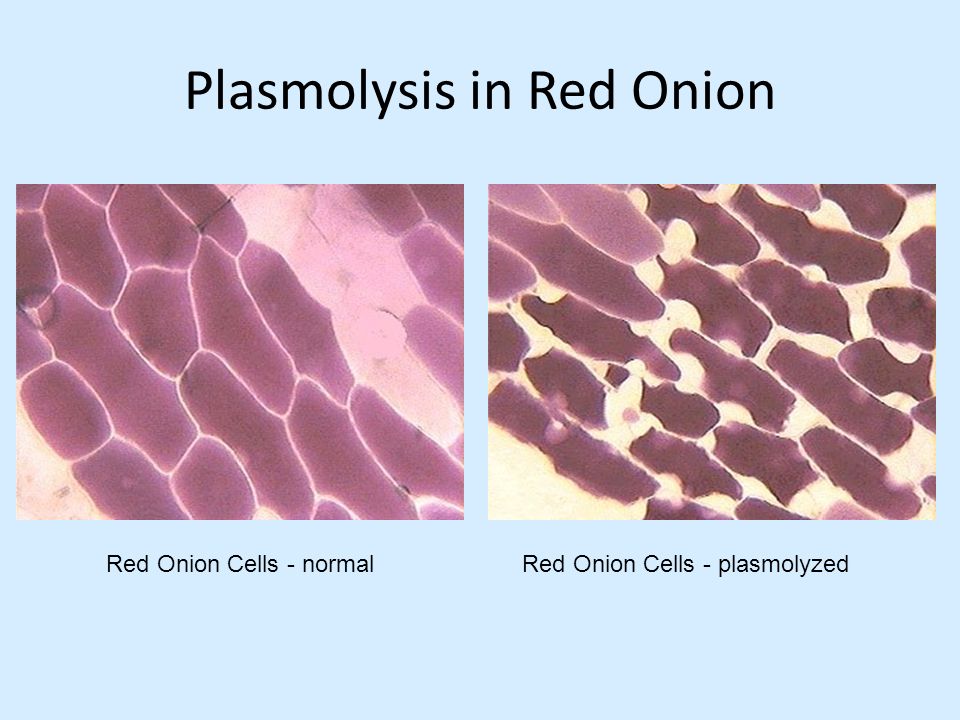 Плазмолиз и деплазмолиз в клетках. Плазмолиз и деплазмолиз.