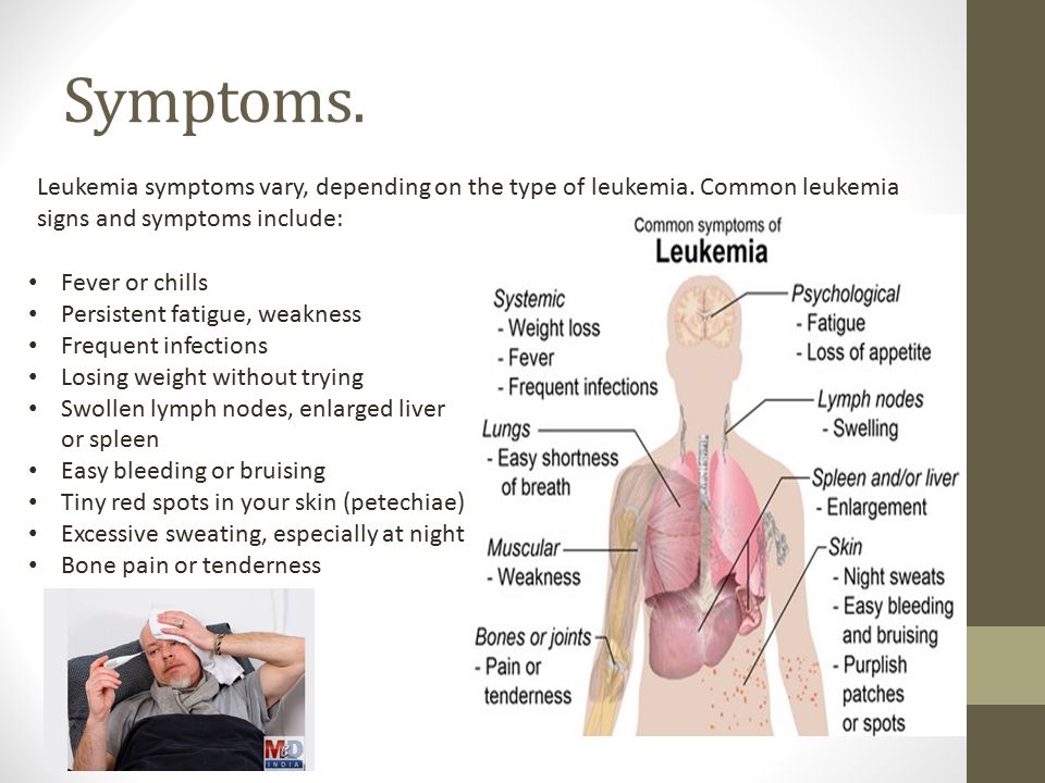 Leukemia symptoms vary, depending on the type of leukemia. 