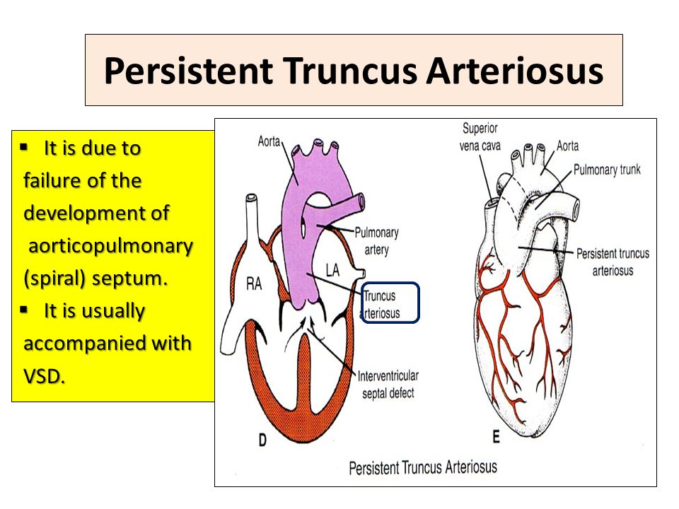 Persistent. Persistent Truncus Arteriosus. Persistence Truncus Arteriosus. Трункус артериозус. Артериальный на латинском Arteriosus.