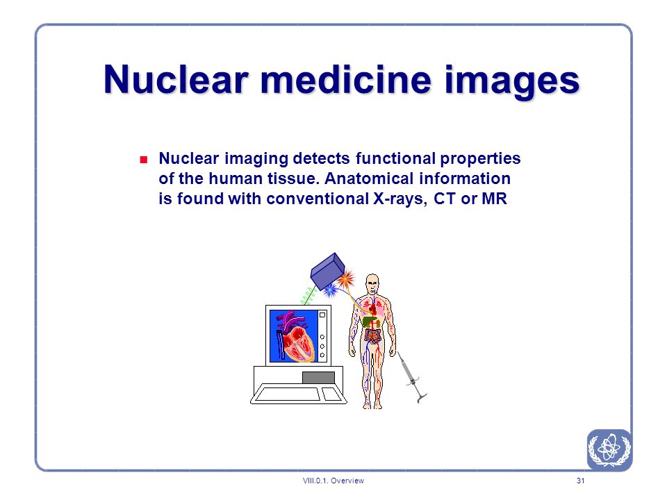 Nuclear medicine images