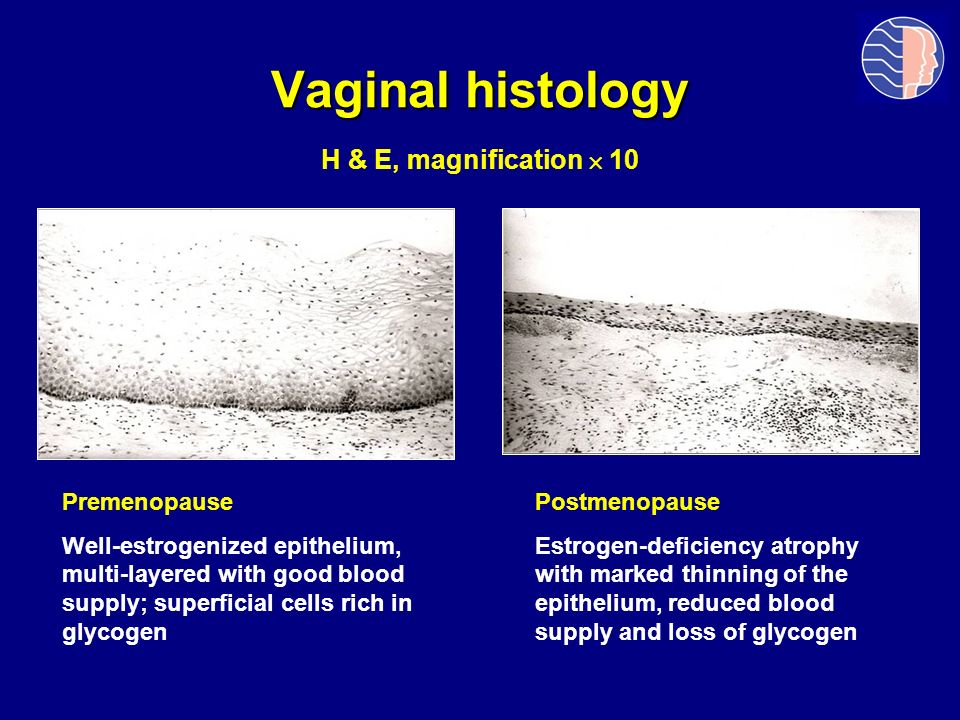 Vaginal histology H & E, magnification  10 Premenopause