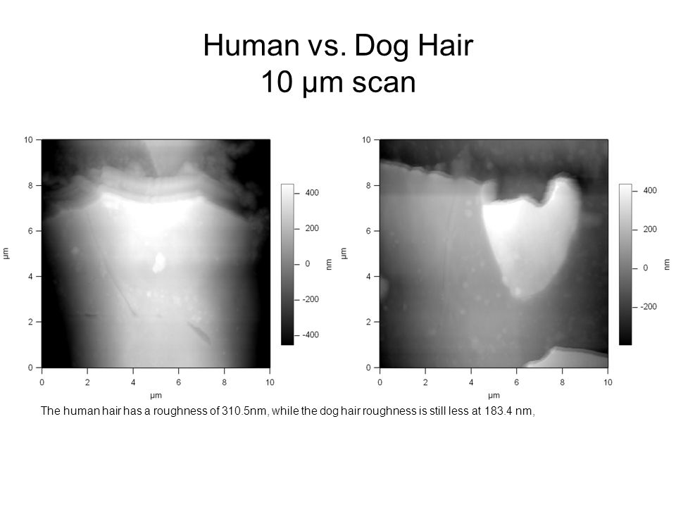 Human vs. Dog Hair 10 µm scan