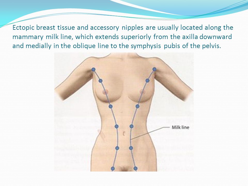 Ultrasound Of The Breast Part 1 Ppt Video Online Download