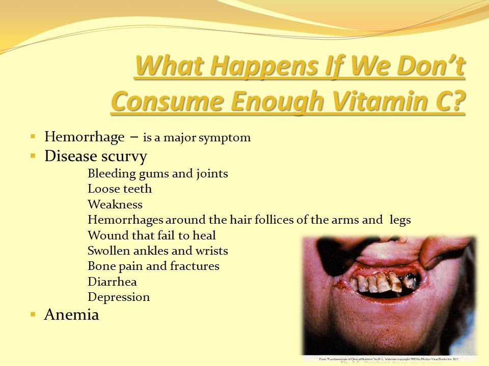 Vitamin C Organic Compound Ascorbic Acid Dehydroascorbic Acid DHA vitamin-c-organic-compound-ascorbic-acid-dehydroascorbic-acid-dha
