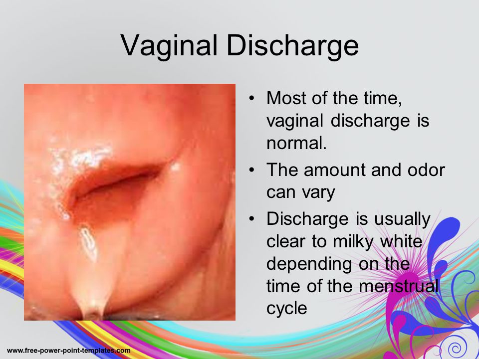 what does normal vaginal discharge look like