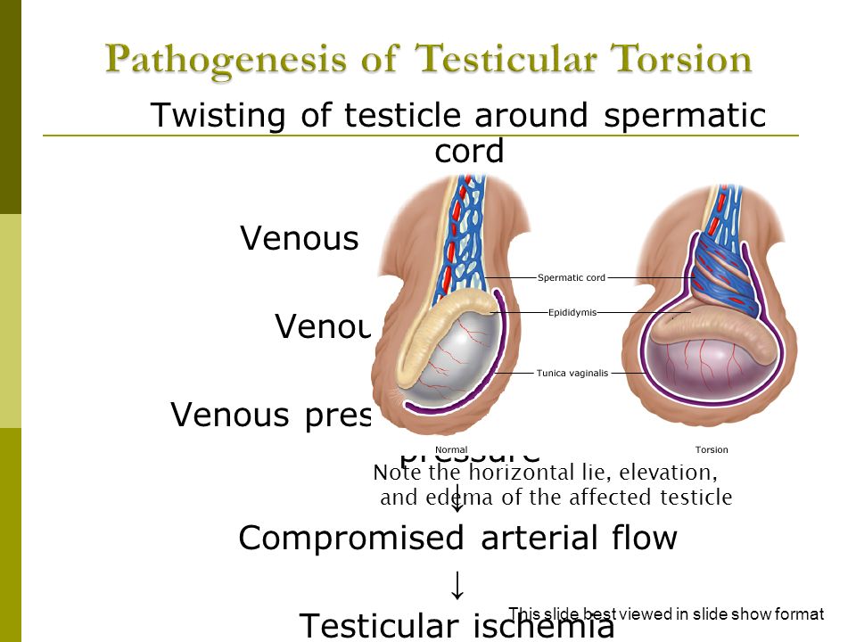 Perspectives On Testicular Sex Cord