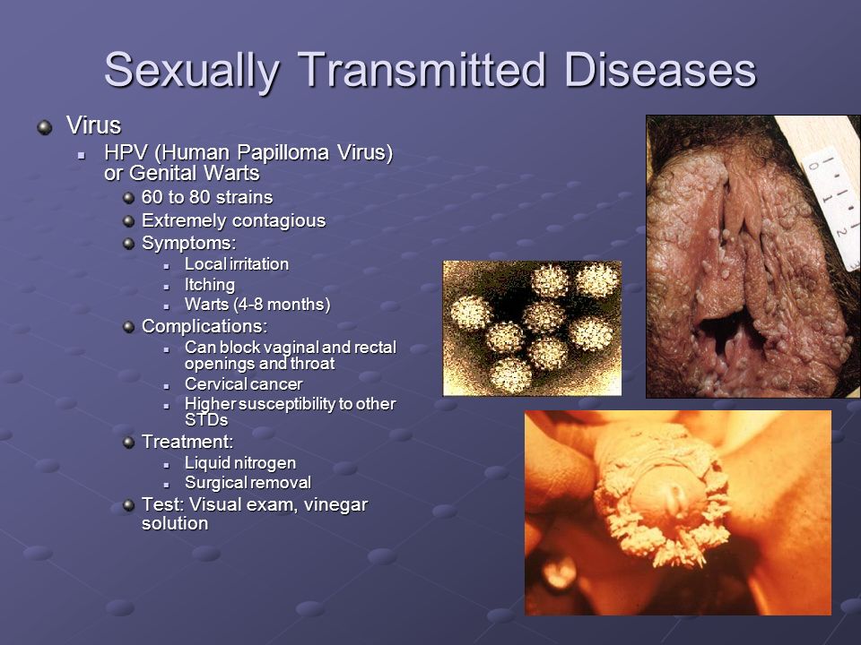 wart virus sexually transmitted