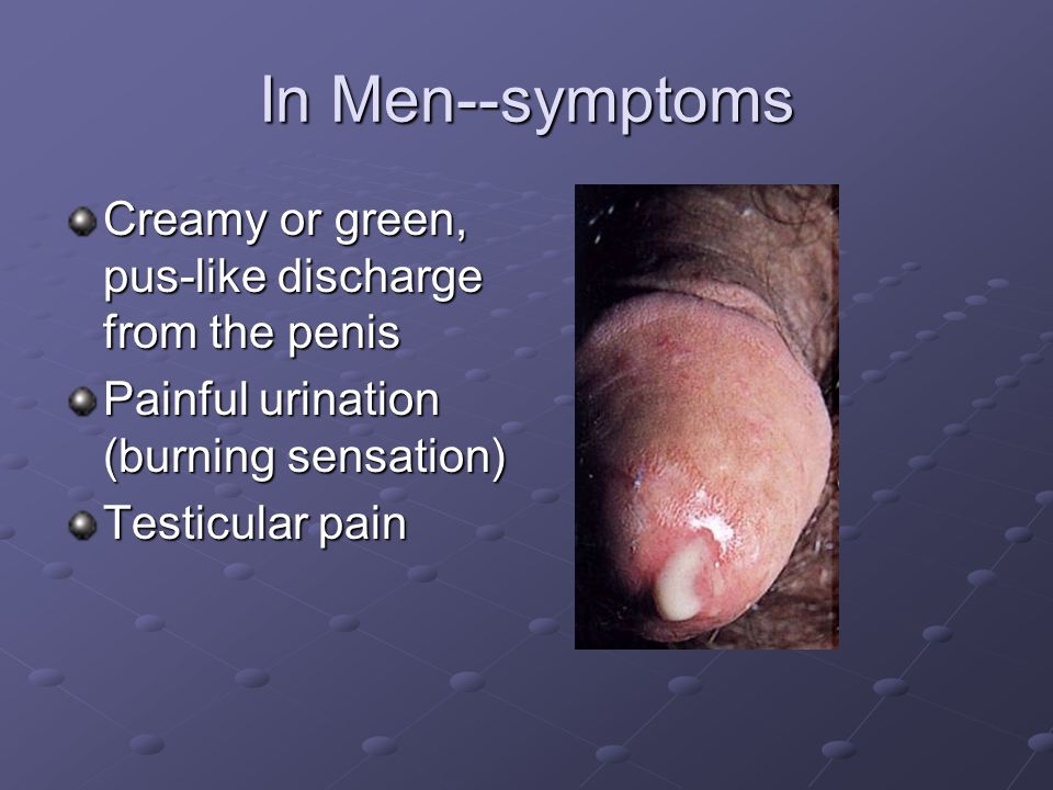 Urethral pain