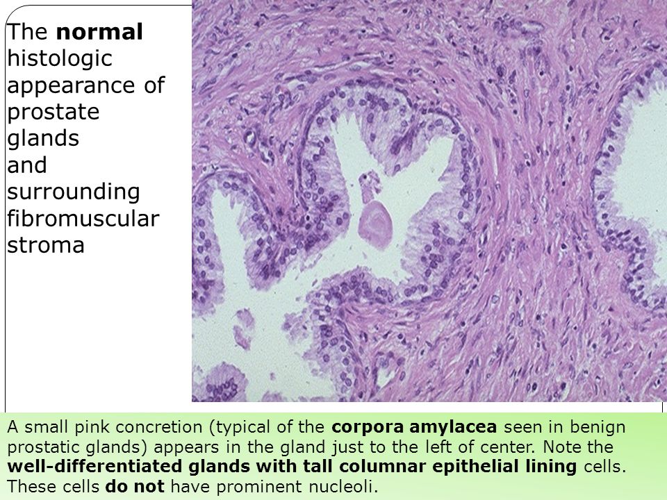 normal size prostate gland with concretions anatomia prostatica seram