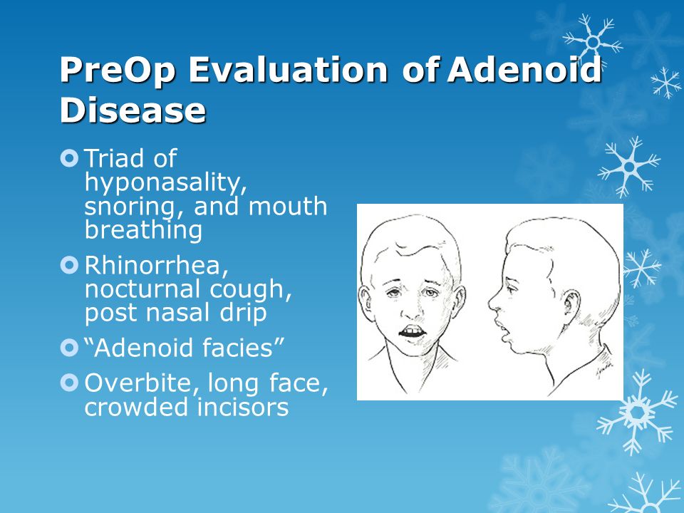 PreOp Evaluation of Adenoid Disease