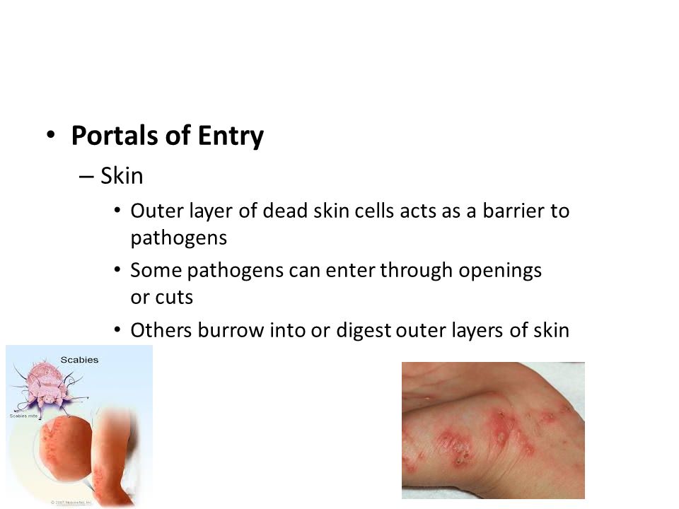 Disease Disease Transmission And Epidemiology Ppt Video Online Download