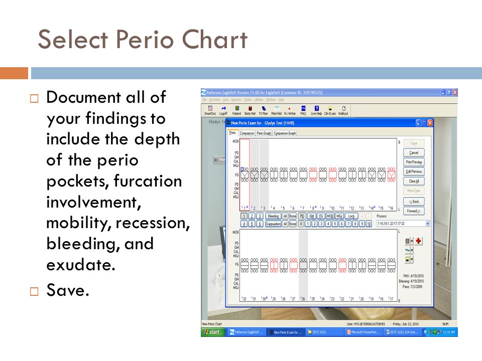 Eaglesoft Perio Charting